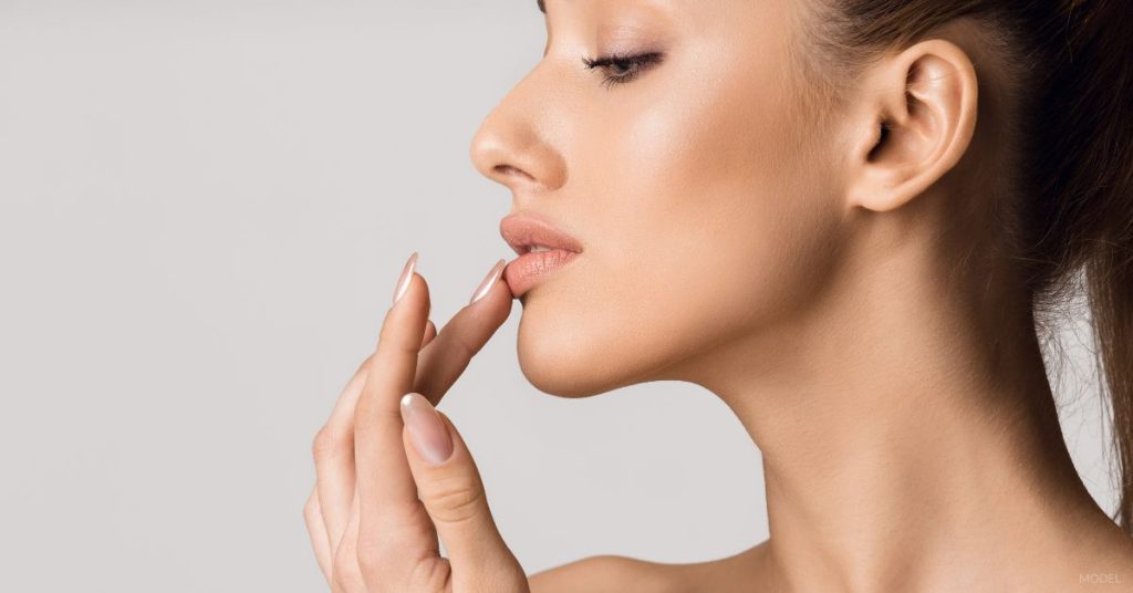 Woman after lip fillers. (Model)